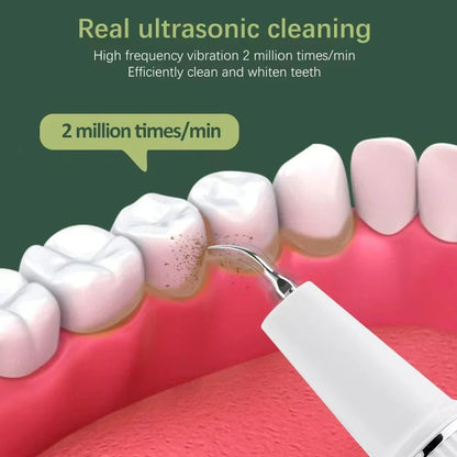 Ultrasonic Teeth Cleaner Tartar Remover Plaque Cleaning Device